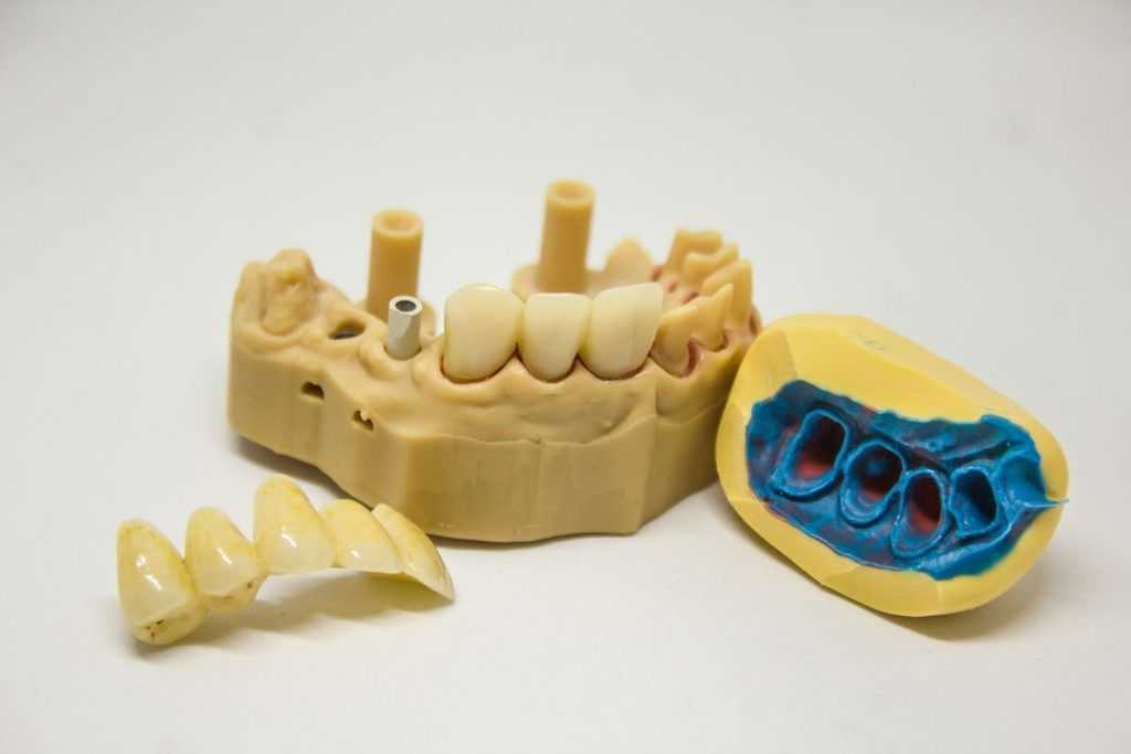 Significado de los dientes podridos
